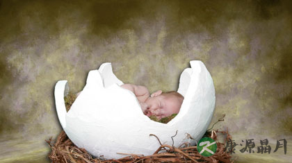 新生儿黄疸正常值是多少