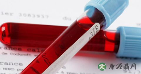 白血病传染吗 白血病传染吗