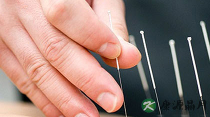 小儿可以针灸吗 小儿针灸注意事项