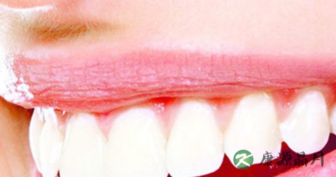 牙齿变黄的原因