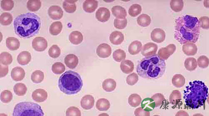 白细胞正常值范围是多少