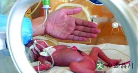 黄疸的病因分类