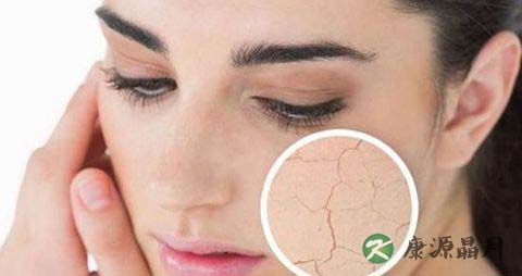 长期睡眠不足头疼怎么办