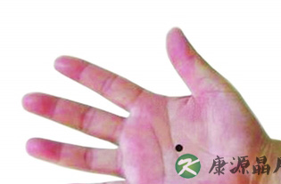 穴位按摩 治好你的病