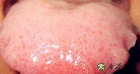 齿痕舌怎么调理