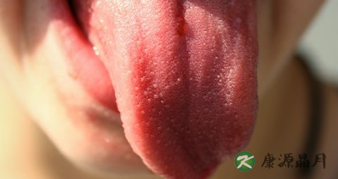 舌头上有很多小红点是什么原因