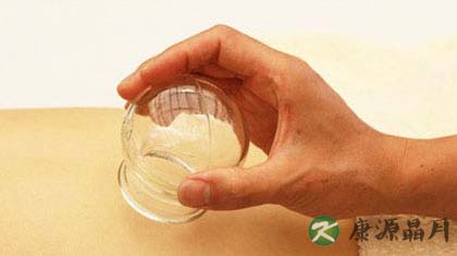 拔火罐能治风湿病吗