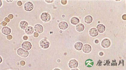 白细胞高的原因