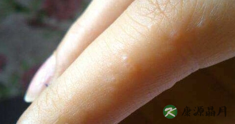 手气传染吗 手气传染吗