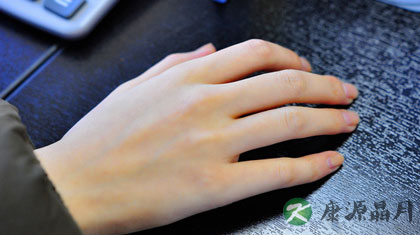 灰指甲的治疗方法