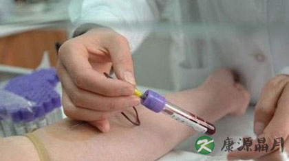 血常规检查项目有哪些