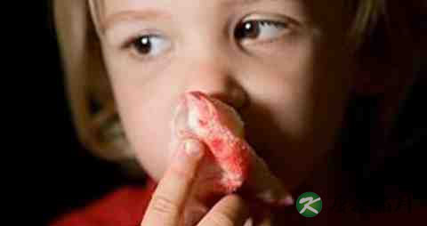 长期睡眠不足流鼻血怎么办