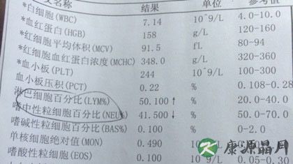 中性粒细胞百分比偏高的原因 中性粒细胞百分比偏高的原因