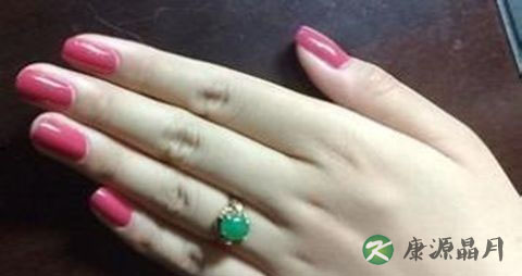 冬天手上生冻疮怎么办