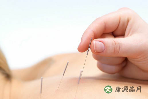 什么是针灸养生 什么是针灸养生