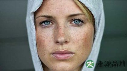 中医疾病理论解读黄褐斑