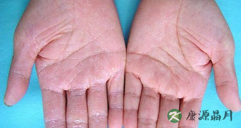 手气传染吗 手气传染吗