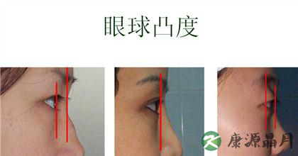 甲亢病症状的具体表现