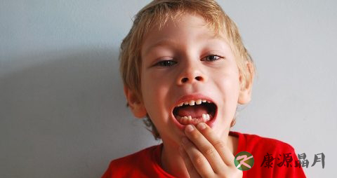 怎样预防龋齿 怎样预防龋齿