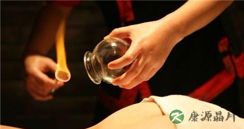 白领拔罐有助缓解后背疼痛