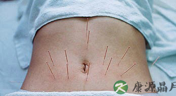 针灸减肥的五大减肥误区