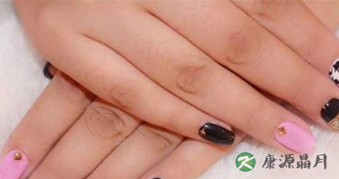 冬天手裂用什么能预防