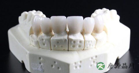 装烤瓷牙疼吗 装烤瓷牙疼吗