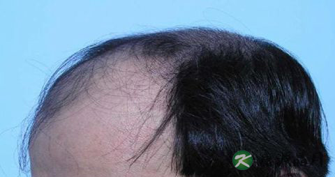 中医教你冬补夏吃治未病