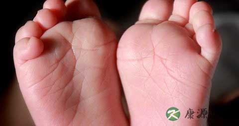 冬天手脚冰冷是宫寒吗 冬天手脚冰冷是宫寒吗