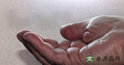 手上长肉刺缺什么 手上长肉刺缺什么