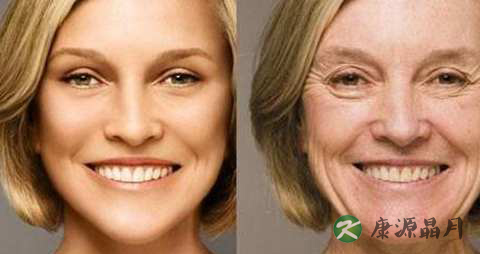 乳腺癌早期症状有哪些