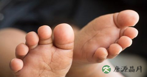 治疗脚气最好的办法