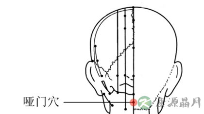 哑门穴在什么地方