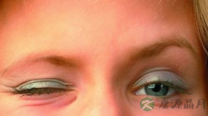 眼皮跳是什么原因造成的呢 眼皮跳是什么原因造成的呢