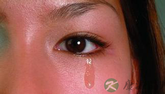 迎风流泪需小心 或肾阴虚所致