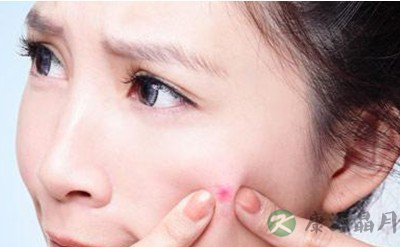 脸颊青春痘可通过喝汤治疗