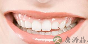 是否长智齿就一定要拔出呢? 是否长智齿就一定要拔出呢?