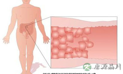 益生菌被夸大其词 常人勿特殊补充