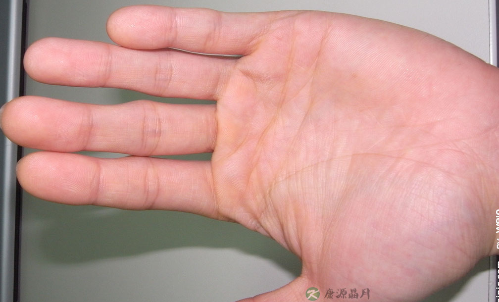 看手掌识健康