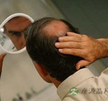 男性养生常识 为何男性在夏季容易脱发?