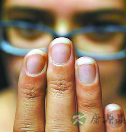 从五指看出健康