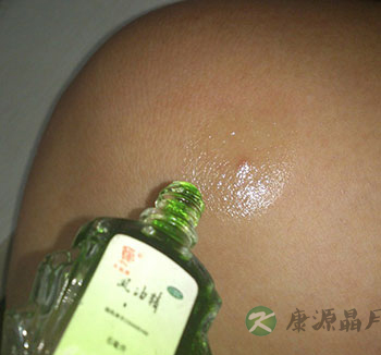 盘点风油精哪些不为人知的妙用