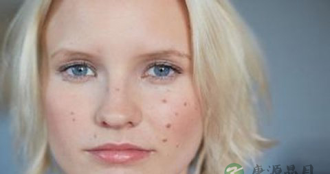 痔疮如何治 治疗痔疮的19个偏方