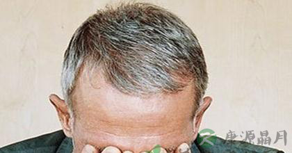 白发变黑的偏方有哪些