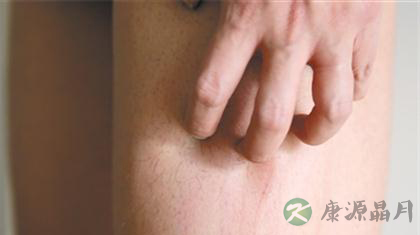 中医治皮肤瘙痒偏方大全