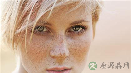16个民间治疗雀斑的偏方