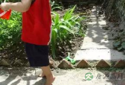 2岁宝宝内八字、踮脚尖走路 祸根竟是学步车