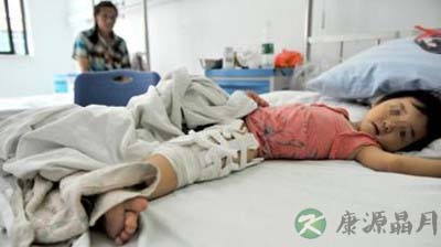 成都2岁半女童连玩蹦床4小时导致左腿骨折