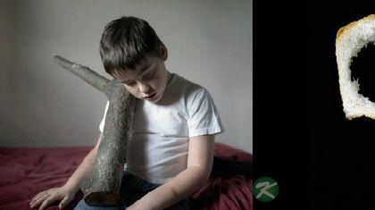 得了外向孤独症怎么办 得了外向孤独症怎么办