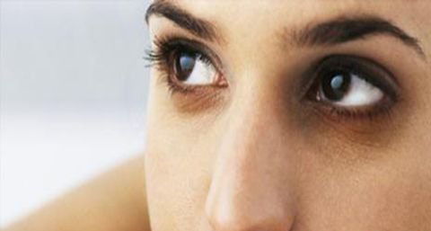 引起黑眼圈的原因有哪些呢 引起黑眼圈的原因有哪些呢